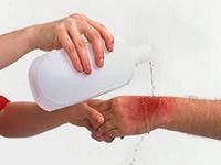 Узловатая эритема: фото, причины, лечение, осложнения, профилактика