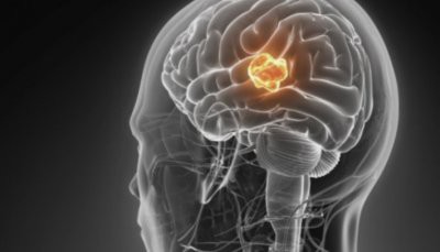 Медики рассказали о звездной болезни Анастасии Заворотнюк