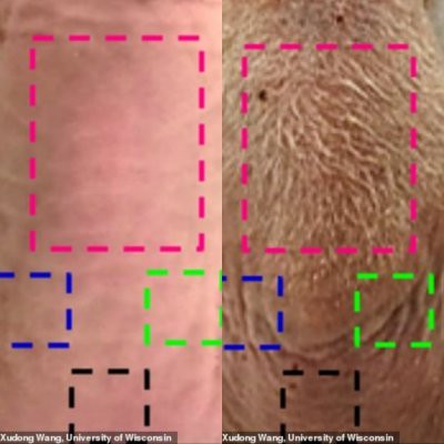 Создана кепка, спасающая от облысения