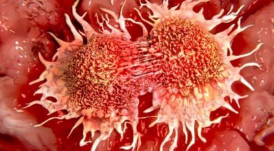 Ученые заявили, что редкое деление клеток у людей пожилого возраста снижает вероятность развития онкологических заболеваний