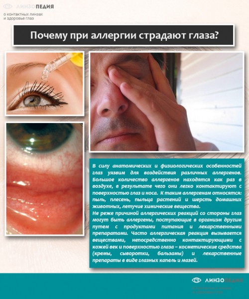 Синяки под глазами у ребенка: 12 возможных причин, методы лечения и профилактики