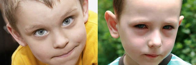 Синяки под глазами у ребенка: 12 возможных причин, методы лечения и профилактики