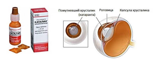 Альбуцид при насморке у детей: применение и эффективность, отзывы и мнение врача