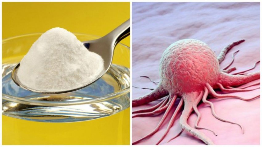 Учёные объяснили, можно ли вылечить рак содой