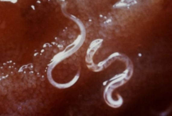 Каждый пятый человек на Земле заражен паразитическим круглым червем токсокарой