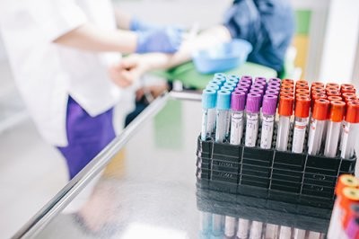 Врач-инфекционист назвала 10 анализов, на которые не стоит тратить деньги