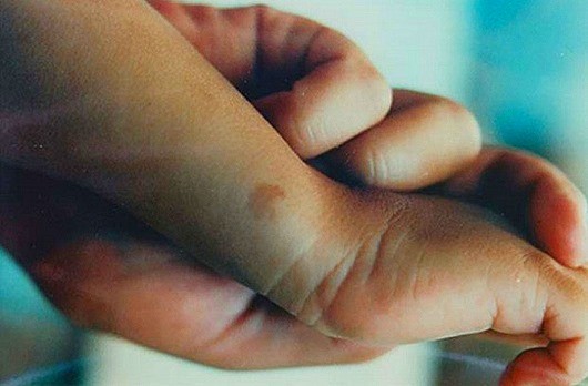 ТОП-10 клинических подтверждений реинкарнации