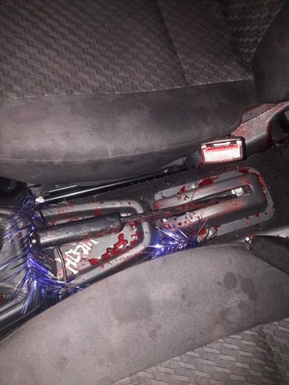 В Волгограде рецидивист ранил ножом женщину-таксиста В Волгограде рецидивист ранил ножом женщину-таксиста