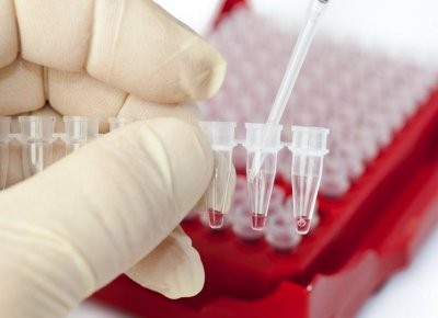 Врачи рассказали, как понять, что у человека проблемы с иммунитетом