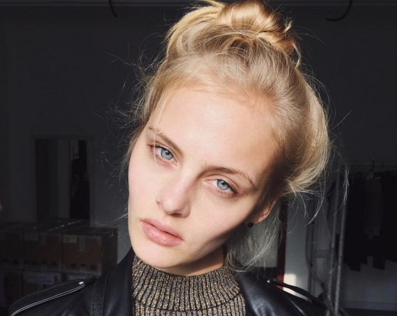 Модель Ксения Пунтус находится в реанимации в тяжелом состоянии после падения из окна