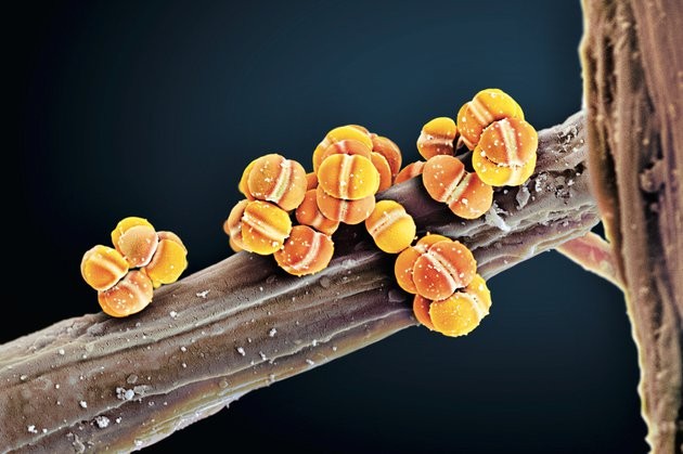 Квинтиллионы микробов в человеке определяют нашу сущность