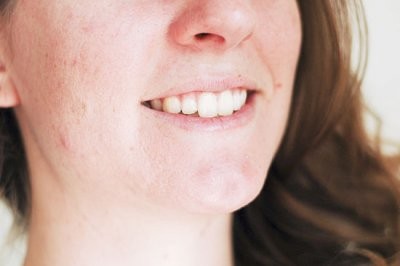 Эксперты назвали семь признаков старения, которые должны насторожить