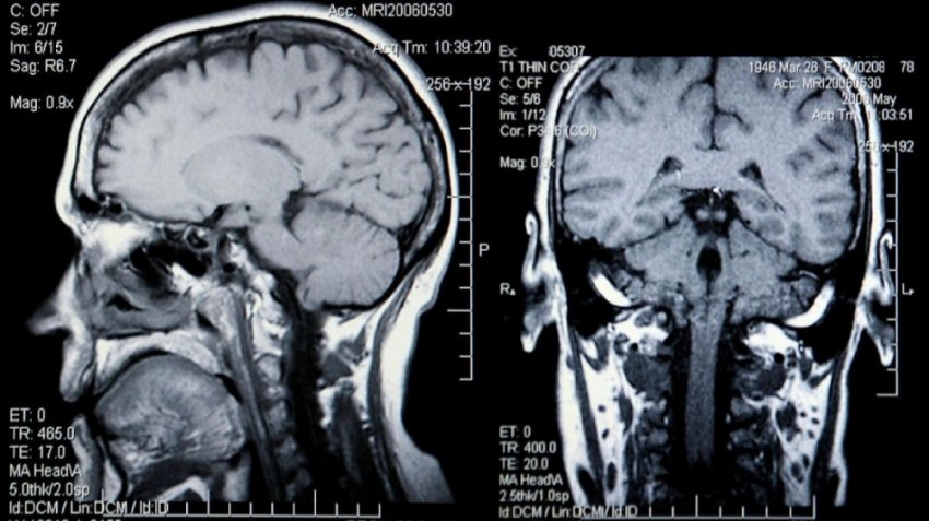Чем опасен МРТ и как откладываются токсичные вещества