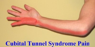 Зарубежные медики назвали недуги, которые развиваются при использовании смартфонов