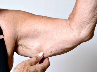 Врач назвал признаки, которые указывают на дефицит тестостерона у женщин