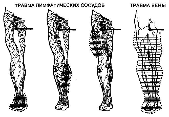 Многофункциональное строение лимфатических узлов человека