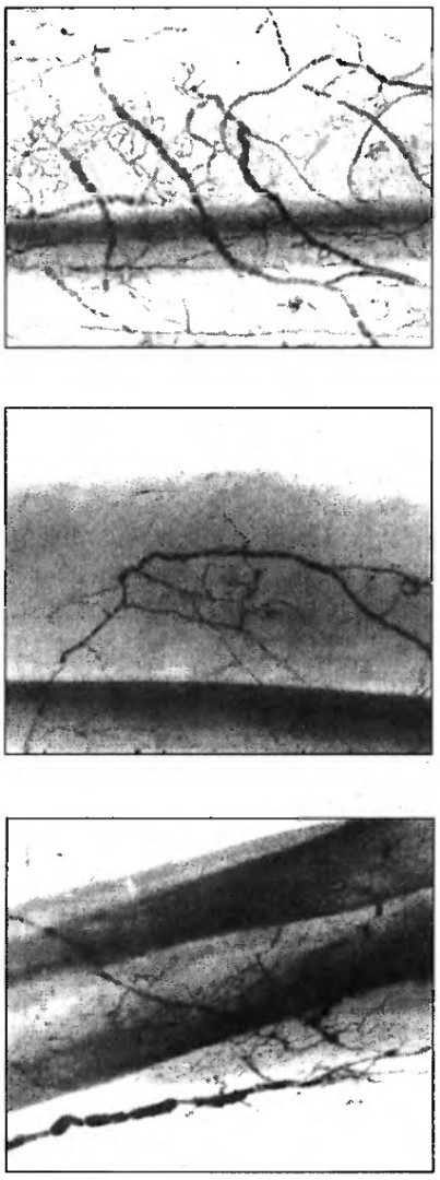Многофункциональное строение лимфатических узлов человека