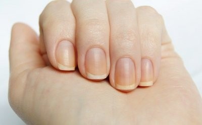Эксперты рассказали, о каких болезнях может предупреждать исчезновение белых лунок на ногтях