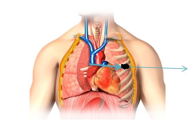 Самоубийство Маяковского оказалось случайным выстрелом
