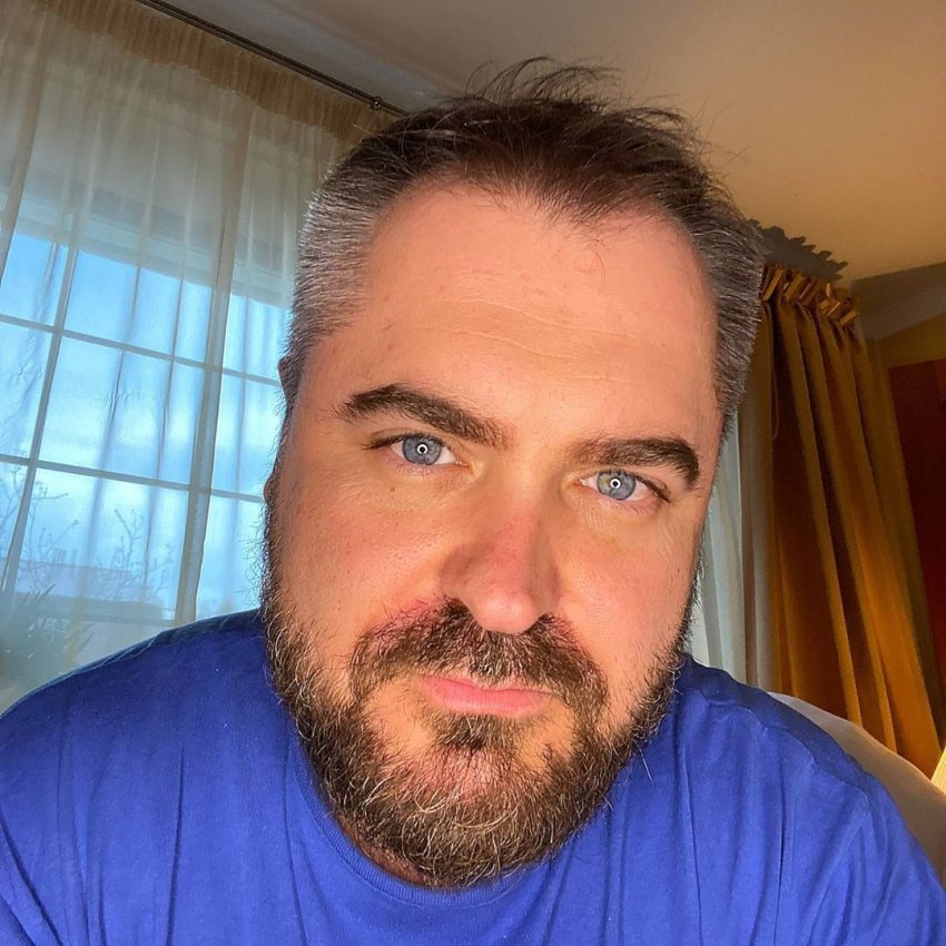 Гражданский муж Бабкиной из-за переживаний лишился волос