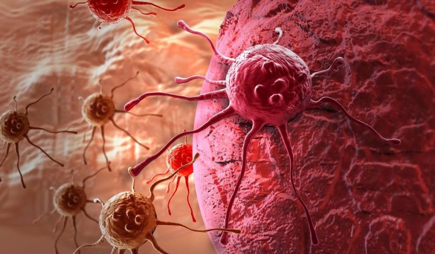 Онколог рассказал, какие эмоции могут стать причиной развития рака