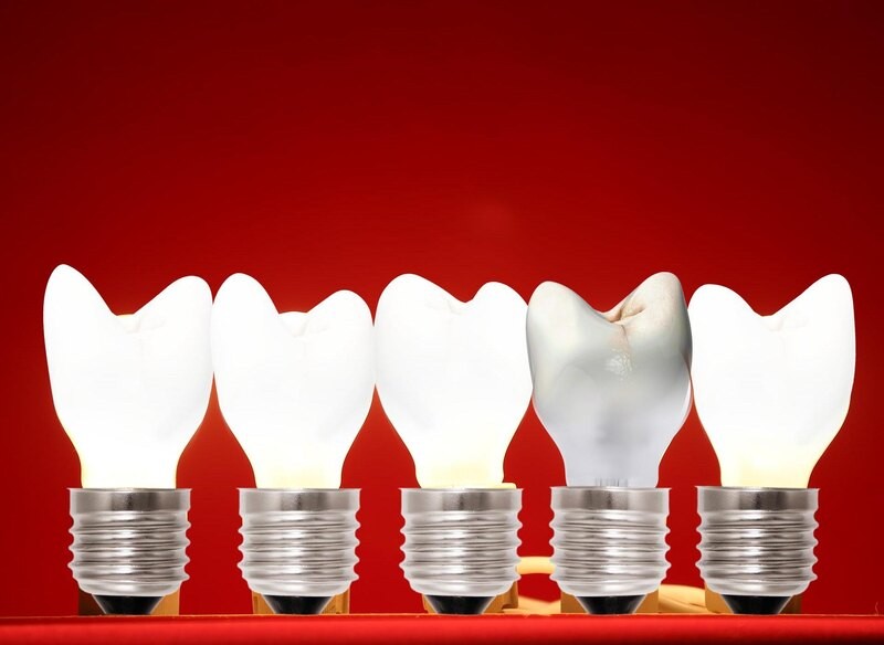 Откуда взялся кариес и можно ли его победить?