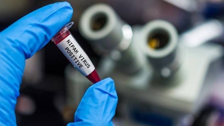 Что можно ожидать в 2021 году от вируса Nipah, вспышки которого фиксируются в странах Азии Что можно ожидать в 2021 году от вируса Nipah, вспышки которого фиксируются в странах Азии