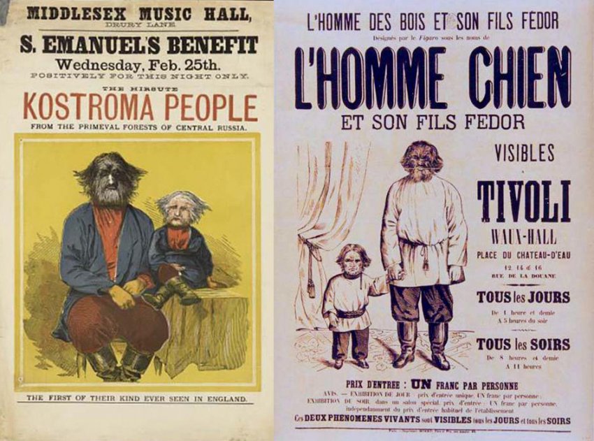 Фёдор Евтихиев: волосатый человек из Костромы