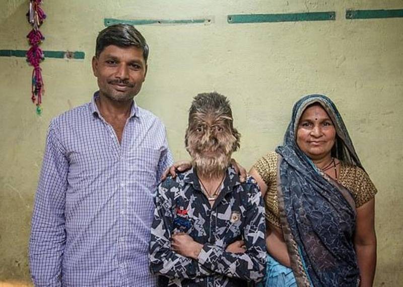 Чем занимаются люди с жуткими особенностями: безрукие, с четырьмя ногами, без сердца