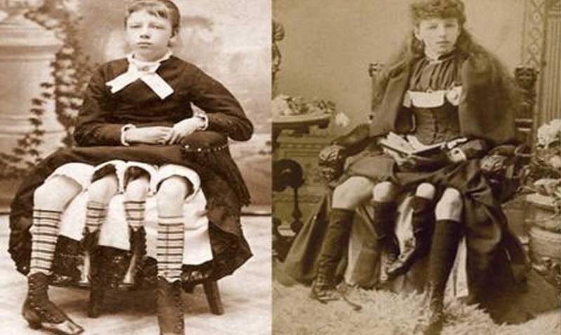 Чем занимаются люди с жуткими особенностями: безрукие, с четырьмя ногами, без сердца