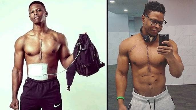 Чем занимаются люди с жуткими особенностями: безрукие, с четырьмя ногами, без сердца