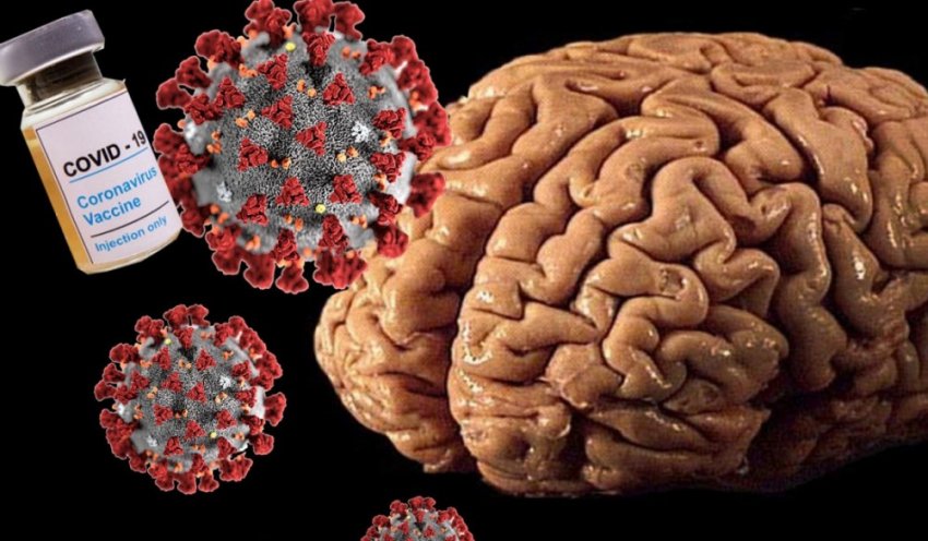 Странные аномалии мозга у переболевших COVID-19