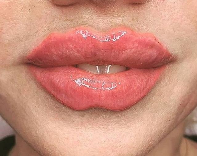 От «уточки» к «дьяволу»: Instagram предлагает новый вид преображения губ