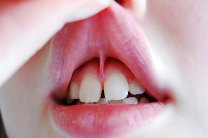 Птеригий, фильтрум, глабелла: На сколько хорошо вы знаете своё тело?