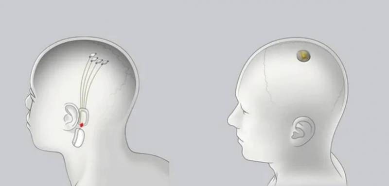 Илон Маск собирается усилить мозговую деятельность человека, соединив его с компьютером