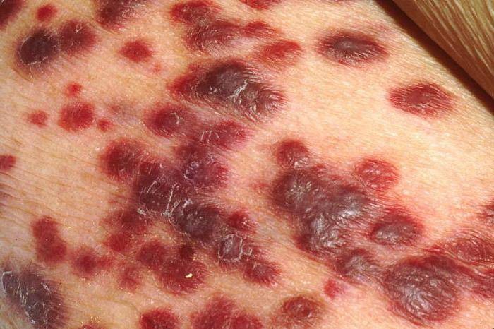 Как вести себя при контакте с медузой-крестовиком: опасно ли это морское животное для человека