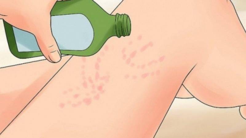 Как вести себя при контакте с медузой-крестовиком: опасно ли это морское животное для человека