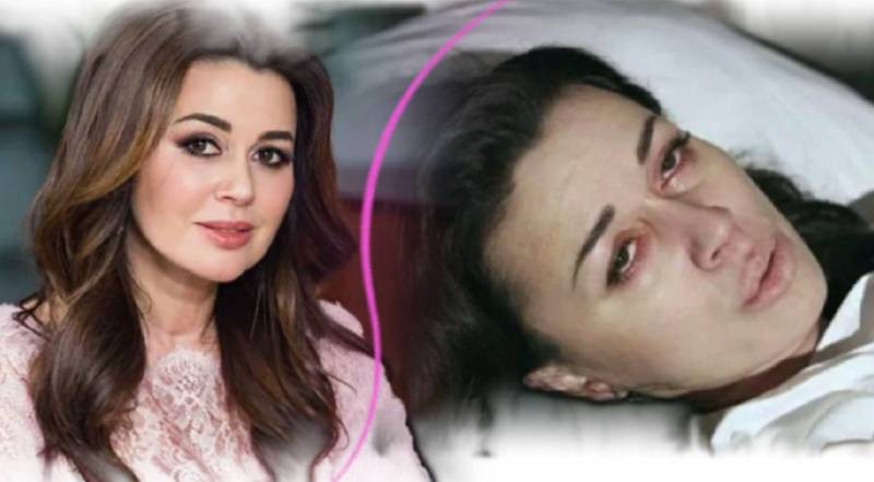 Как изменилось лицо Заворотнюк: обсуждение последнего фото